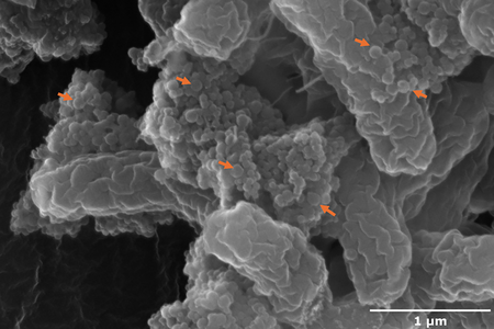 Black and white microscopic view of nanoplastics on bacteria