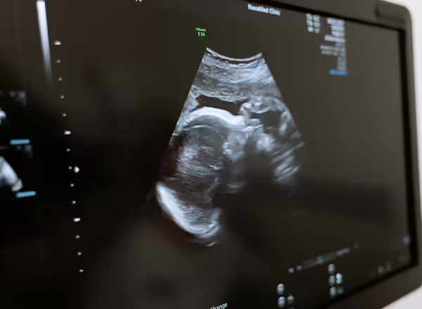 ultrasound
