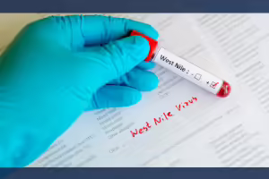 west nile virus test
