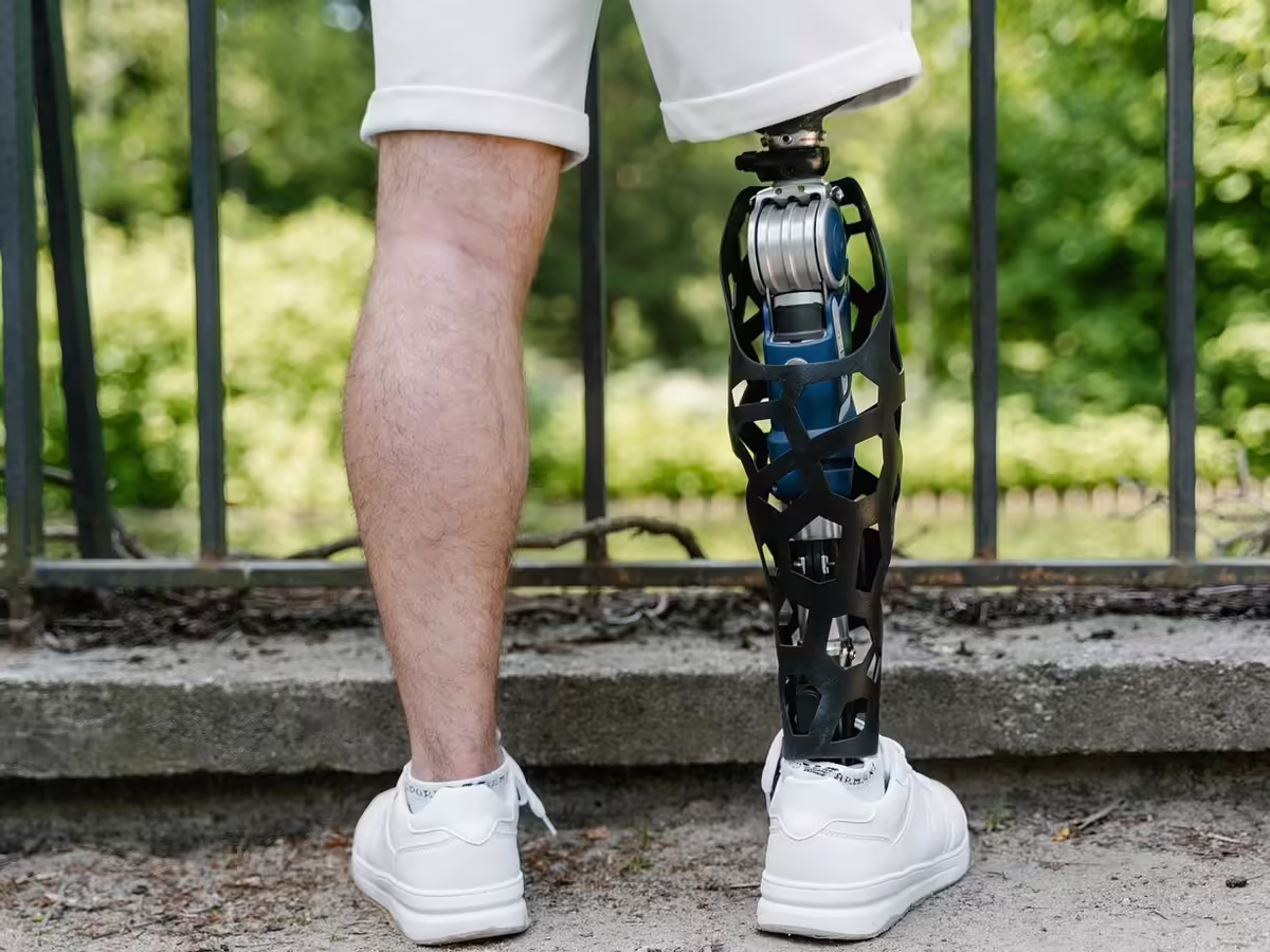 man with artificial leg
