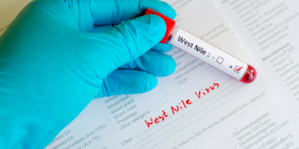 west nile virus test